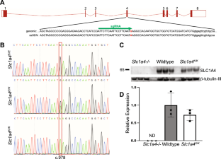 Generation and characterization of a knock-in mouse model for spastic tetraplegia, thin corpus callosum, and progressive microcephaly (SPATCCM).