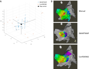 Novel algorithm for fully automated rapid and accurate high definition electrogram acquisition for electroanatomical mapping.