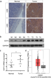 Effects of abnormal expression of CD73 on malignant phenotype of nasopharyngeal carcinoma