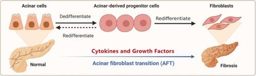 Acinar cells and the development of pancreatic fibrosis