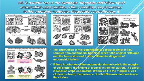 A review of the directly sampled endometrial cytology on LBC samples: Classification, microscopic criteria and beyond