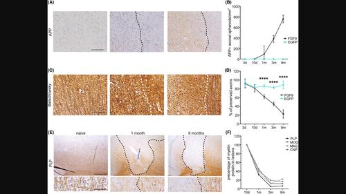 Fibroblast growth factor 9 (FGF9)-mediated neurodegeneration: Implications for progressive multiple sclerosis?