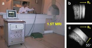 A History of Compact MRI Systems in Tsukuba (1986–2018)