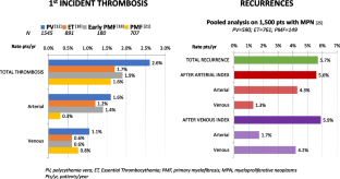 Clonal Hematopoiesis in Myeloproliferative Neoplasms Confers a Predisposition to both Thrombosis and Cancer.