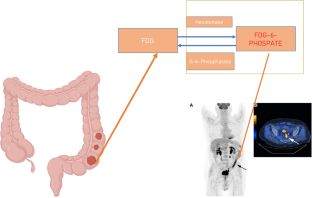 PET/CT in assessment of colorectal liver metastases: a comprehensive review with emphasis on <sup>18</sup>F-FDG.