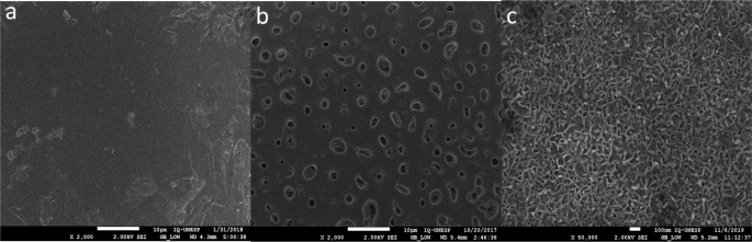 Bacterial response to Ti-35Nb-7Zr-5Ta alloy incorporated with calcium, phosphate and magnesium