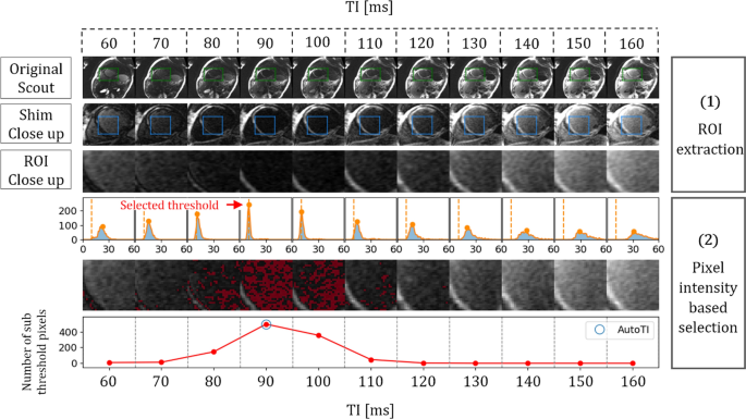 Automated inversion time selection for black-blood late gadolinium enhancement cardiac imaging in clinical practice.