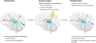 The Thalamus in Perioperative Neurocognitive Disorders.