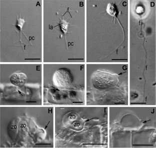 Study of a new strain of Sanchytrium tribonematis expands our knowledge on Sanchytriomycota (Fungi)