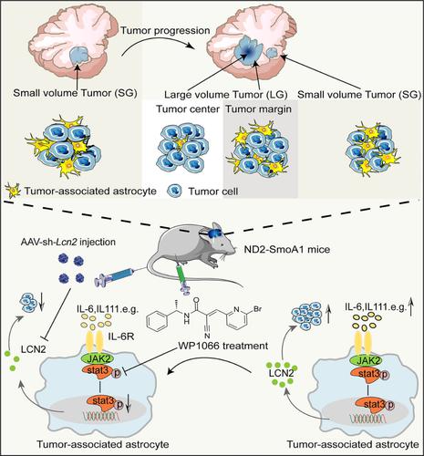 Tumor-associated astrocytes promote tumor progression of Sonic Hedgehog medulloblastoma by secreting lipocalin-2