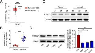 YTHDC1 inhibits cell proliferation and angiogenesis in cervical cancer by regulating m6A modification of SOCS4 mRNA