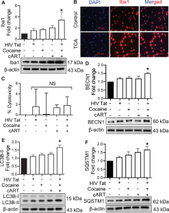 Role of Dysregulated Autophagy in HIV Tat, Cocaine, and cART Mediated NLRP3 Activation in Microglia.