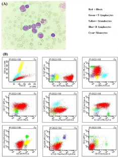 Mixed-phenotype acute leukemia, T/megakaryoblastic: does it really exist?