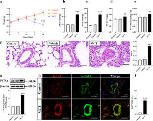 Upregulation of eIF2α by m<sup>6</sup>A modification accelerates the proliferation of pulmonary artery smooth muscle cells in MCT-induced pulmonary arterial hypertension rats.