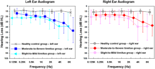 Abnormal Functional Connectivity Within Default Mode Network and Salience Network Related to Tinnitus Severity.