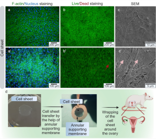 A new technology for the treatment of premature ovarian insufficiency: Cell sheet.