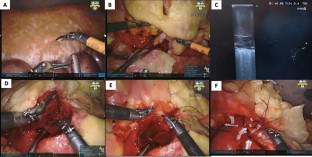 Recent Advances in Surgical Simulation For Resident Education.