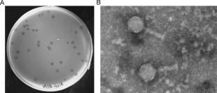 Characterization and genomic analysis of a novel bacteriophage BUCT_49532 lysing Klebsiella pneumoniae.