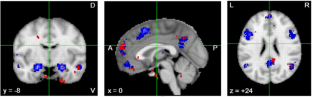 Pathways to Psychopathology Among Autistic Adults.