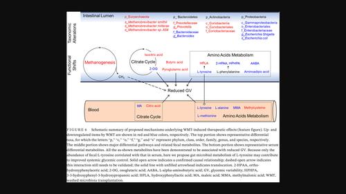 Washed microbiota transplantation reduces glycemic variability in unstable diabetes