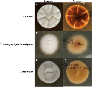 Antifungal Resistance, Susceptibility Testing and Treatment of Recalcitrant Dermatophytosis Caused by Trichophyton indotineae: A North American Perspective on Management