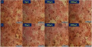 Aflatoxin M1 decreases the expression of genes encoding tight junction proteins and influences the intestinal epithelial integrity.