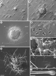 Shedding light on the origin of Acanthocystidae: Ricksol blepharistes gen. n., sp. n. (Ricksolidae fam. n., Panacanthocystida, Centroplasthelida), with notes on the evolution of the genera Acanthocystis, Ozanamia gen. n. (Ozanamiidae fam. n.), and “Heterophrys-like organisms”