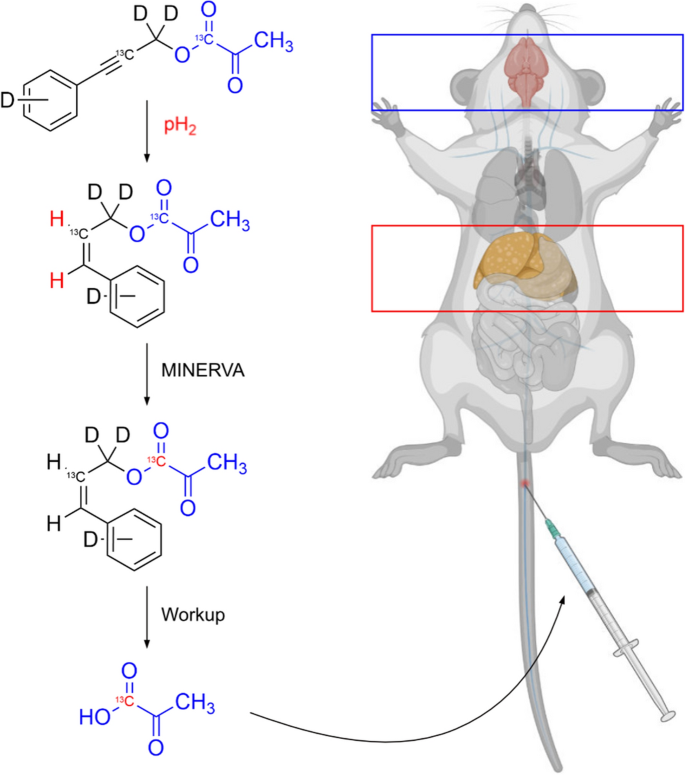 Hyperpolarized Multi-organ Spectroscopy of Liver and Brain Using 1-13C-Pyruvate Enhanced via Parahydrogen