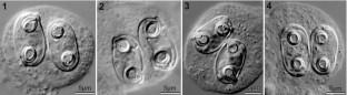 A new species of Ellipsomyxa Køie, 2003 (Bivalvulida) infecting the gall bladder of Pangasius macronema Bleeker (Siluriformes: Pangasiidae) from the Mekong River Delta, Vietnam.