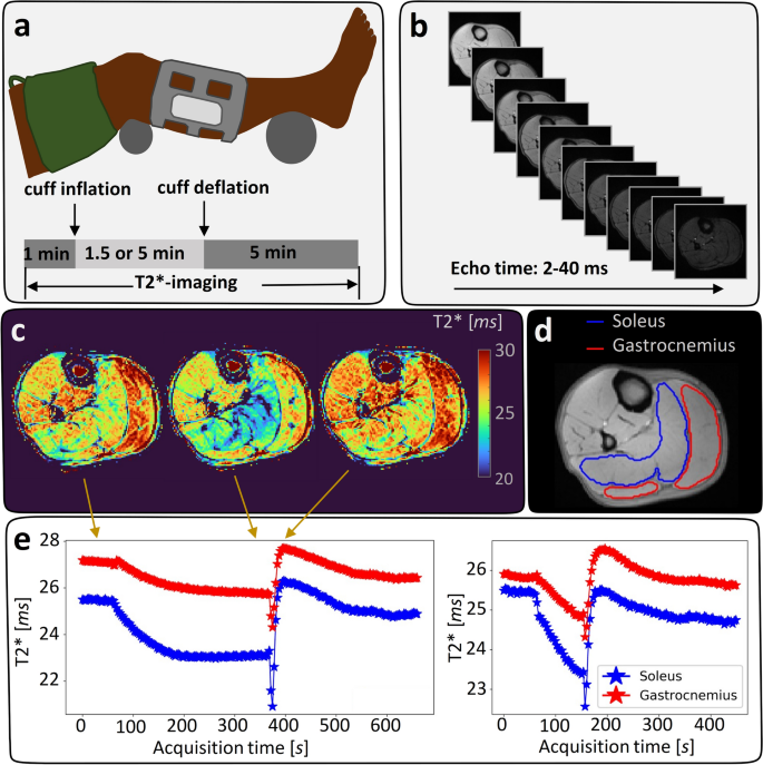 Arterial occlusion duration affects the cuff-induced hyperemic response in skeletal muscle BOLD perfusion imaging as shown in young healthy subjects.