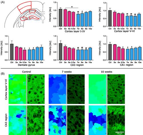 Automated analysis of gray matter damage in aged mice reveals impaired remyelination in the cuprizone model