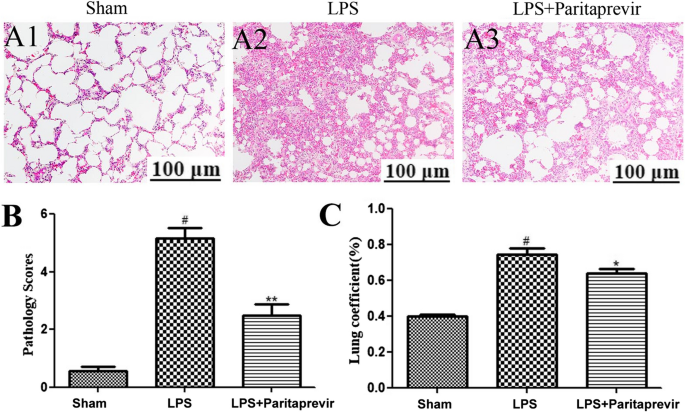 Paritaprevir ameliorates experimental acute lung injury in vitro and in vivo