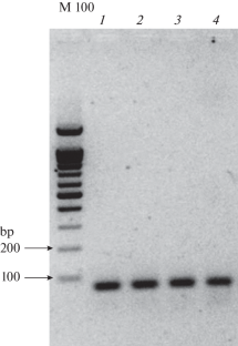 Identification of Clinical Isolates of the Bacillus cereus Group and Their Characterization by Mass Spectrometry and Electron Microscopy