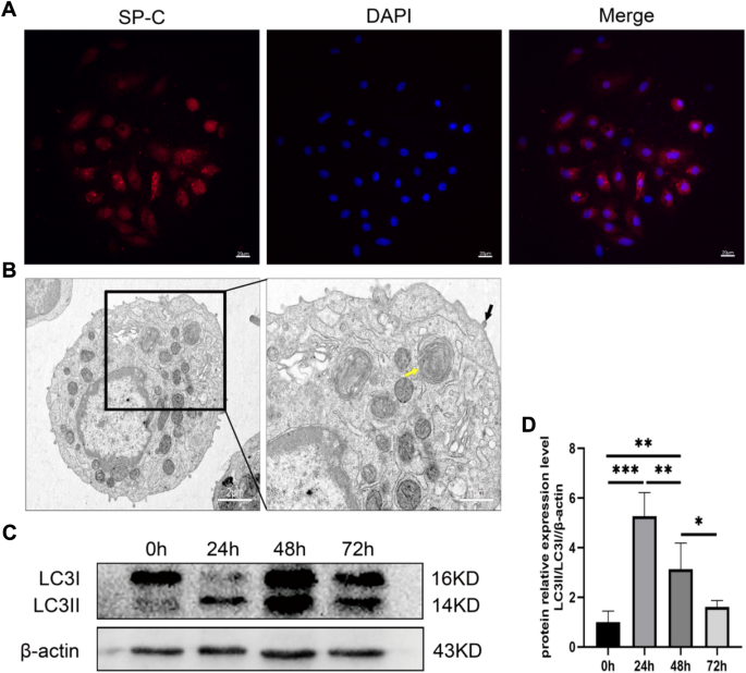 Hyperoxia can Induce Lung Injury by Upregulating AECII Autophagy and Apoptosis Via the mTOR Pathway.