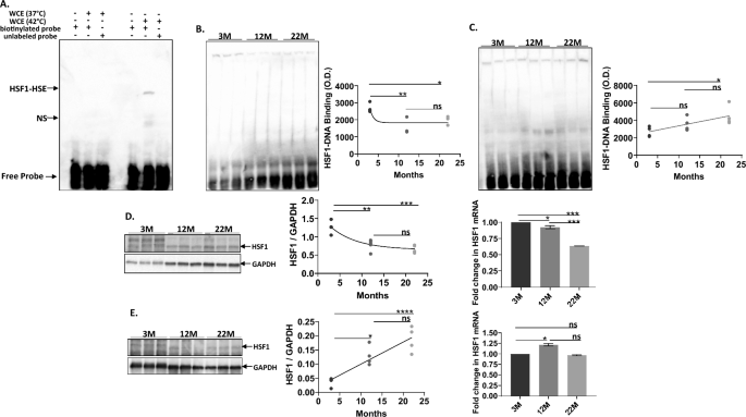 Disrupted HSF1 regulation in normal and exceptional brain aging.