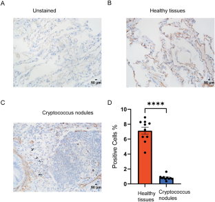 CD146 deficiency promotes inflammatory type 2 responses in pulmonary cryptococcosis.