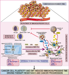 Epithelial-to-mesenchymal transition in cancer progression: unraveling the immunosuppressive module driving therapy resistance.