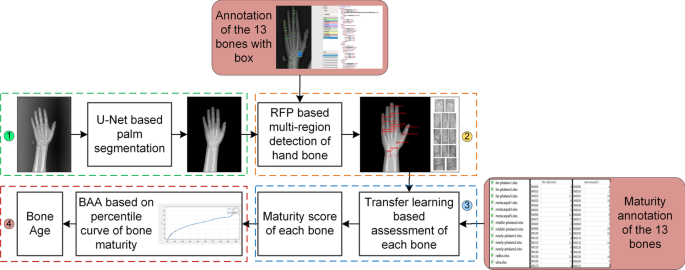 Fine-grained precise-bone age assessment by integrating prior knowledge and recursive feature pyramid network