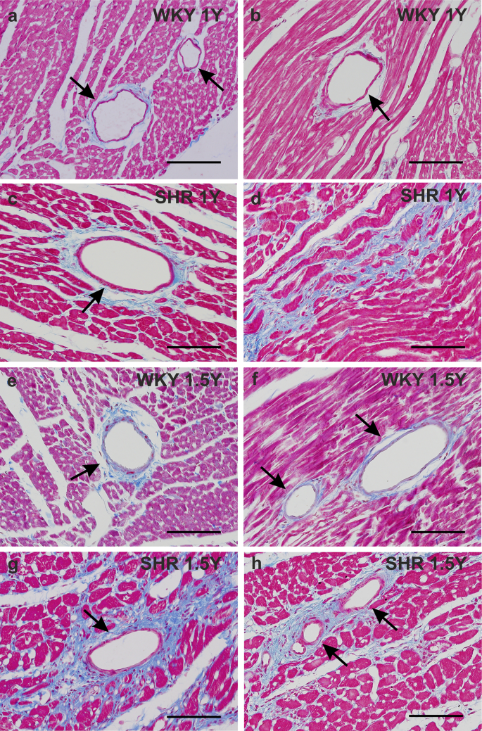 Nestin expression in intact and hypertrophic myocardium of spontaneously hypertensive rats during aging.