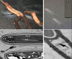 Jirovecia branchilis n. sp. (Microsporidia) from glands of Branchiura sowerbyi (Oligochaeta: Tubificidae) in China