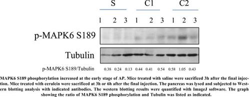 Proteomic analysis of early phosphorylated proteins in acute pancreatitis model