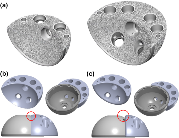 Design, fabrication, and structural safety validation of 3D-printable biporous bone augments