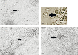 The Disease of the Scallop Mizuhopecten yessoensis (JAY, 1857) in the Mariculture Farms of Primorye Caused by Protozoa of the Genus Perkinsus Levine, 1978