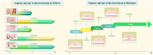 Monkeypox 2022 vs. COVID-19: a Review on a National Health Emergency with Emphasis on Cutaneous Manifestations