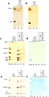 Simple separation of glycosphingolipids in the lower phase of a Folch's partition from crude lipid fractions using zirconium dioxide.