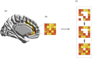 Topological Data Analysis Captures Task-Driven fMRI Profiles in Individual Participants: A Classification Pipeline Based on Persistence.