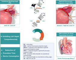 Efficiency of optimal fluoroscopic projection angle defined by computed tomography angiography for left atrial appendage closure