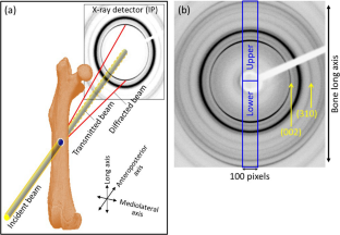 Deterioration of apatite orientation in the cholecystokinin B receptor gene (Cckbr)-deficient mouse femurs.