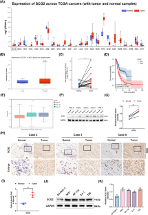 Promoting effect and immunologic role of secretogranin II on bladder cancer progression via regulating MAPK and NF-κB pathways