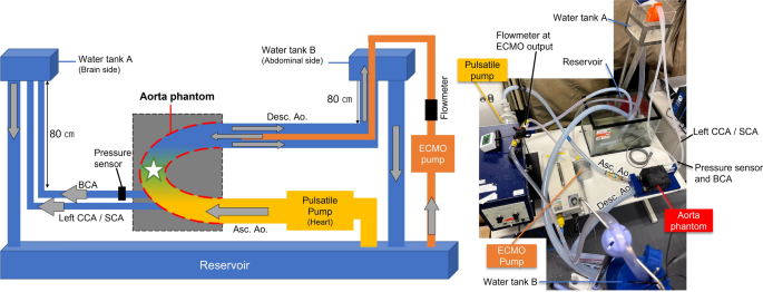 Ultrasound vector flow imaging during veno-arterial extracorporeal membrane oxygenation in a thoracic aorta model.